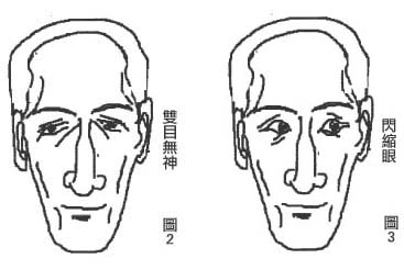 孤峰鼻