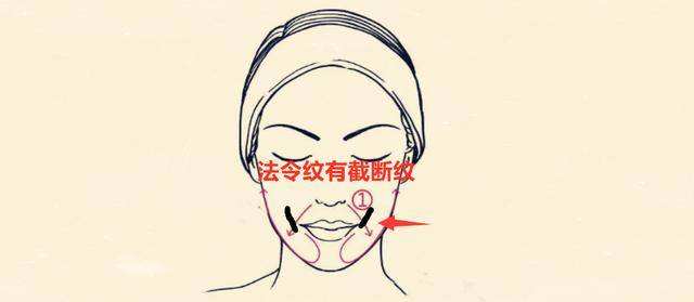 法令线破相有什么预兆吗？