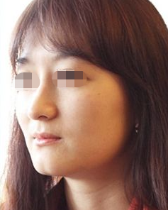 方下巴面相,方下巴的人好吗? 方下巴面相,方下巴的人好吗?