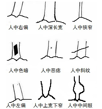 什么是人中面相，人中在哪个部位