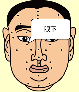 痣有玄机