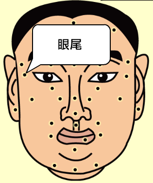 痣有玄机
