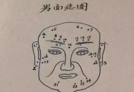 最全男性面相痣图：一痣知富贵