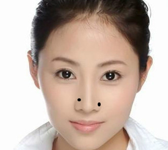 哪些痣相的女人旺夫