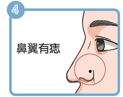 4种在鼻子上的痣，哪种代表了事业有成