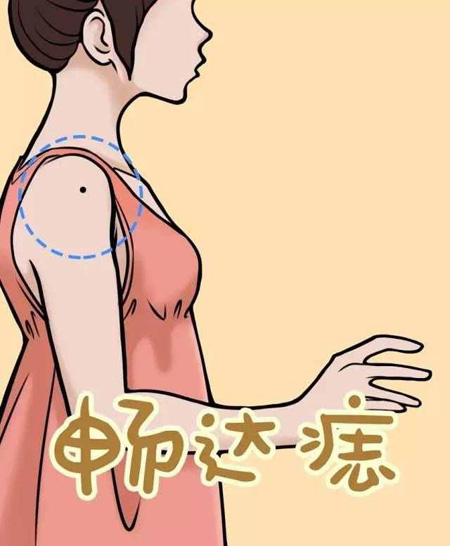 手臂痣相图文详解：你有哪一类痣相呢