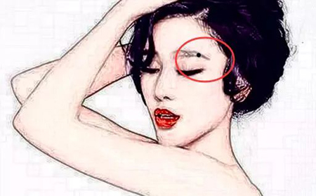贵人痣，脸上四处长吉痣，中奖几率高，事业有人帮