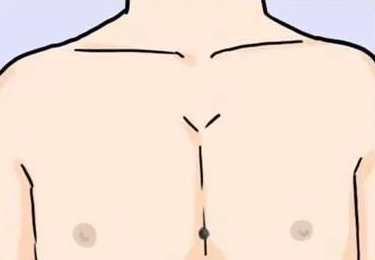 男人、女人、全身痣相算命图解