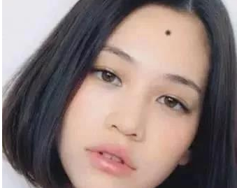 史上最全女人痣相大全