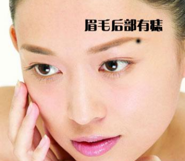 古法算命：算出命运的九处痣