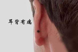 男人耳朵上的福痣