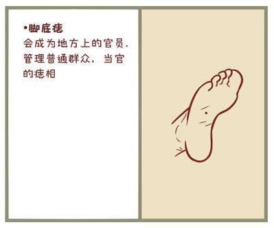 富贵痣在哪里 身体这6处有痣是吉痣，福旺财多，事业有所成