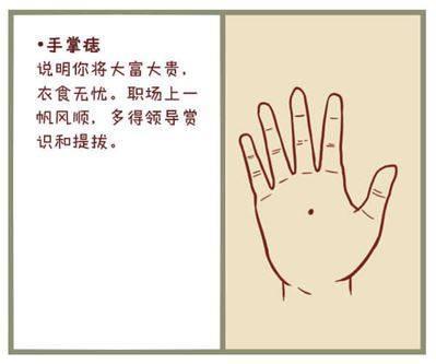 富贵痣在哪里 身体这6处有痣是吉痣，福旺财多，事业有所成
