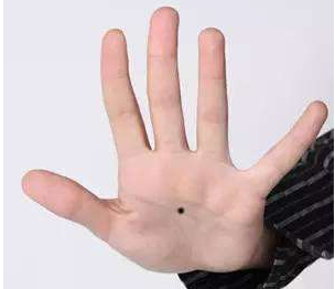 男人手掌有痣的代表什么