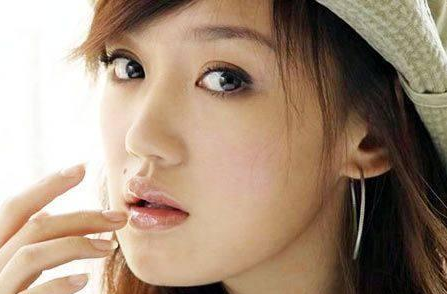 内地脸上带痣的女演员