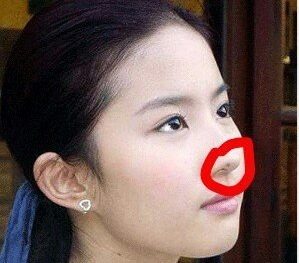 内地脸上带痣的女演员