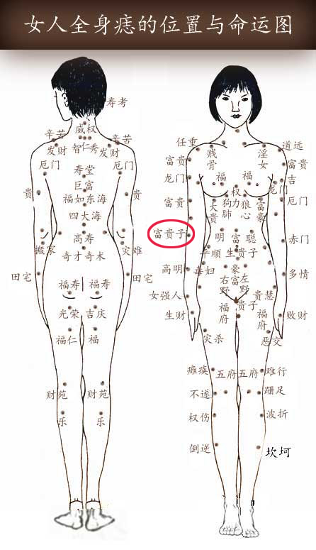 富贵子痣 富贵子痣