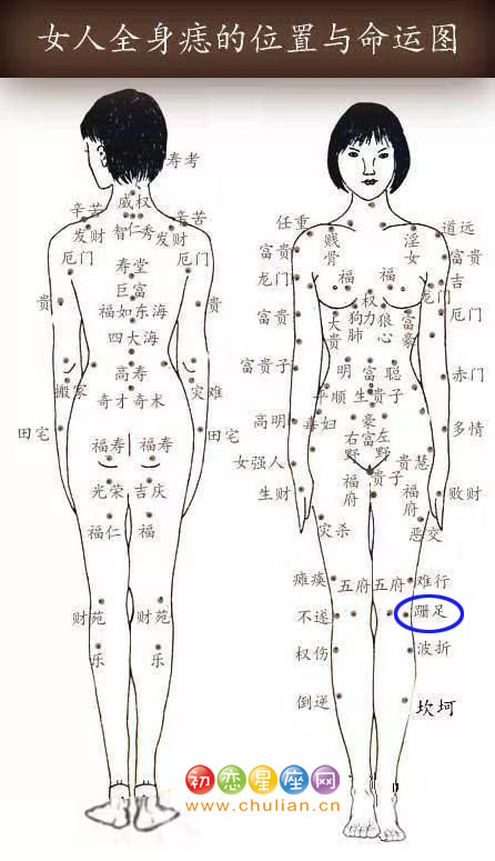 跚足痣 跚足痣