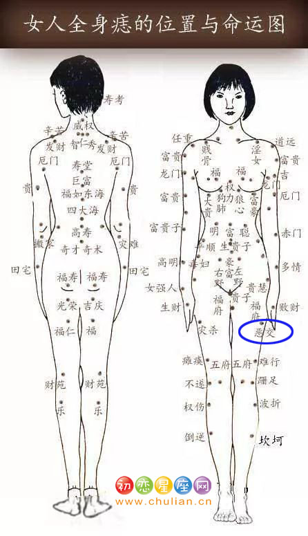 恶交痣 恶交痣