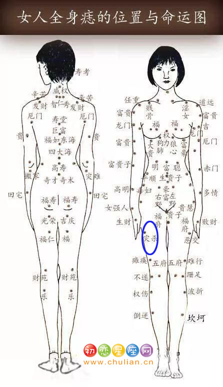 灾杀痣 灾杀痣