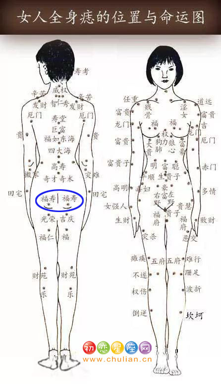 福寿痣 福寿痣