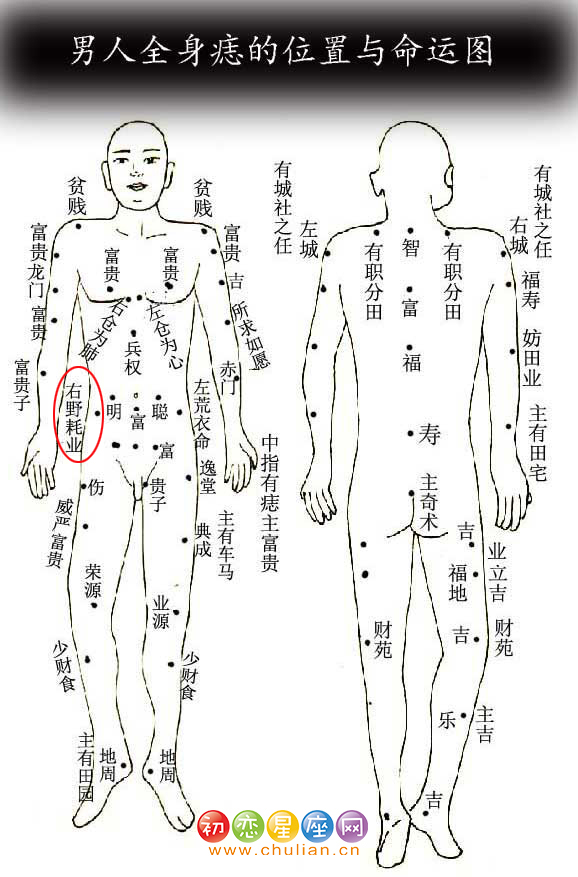 右野耗业痣 右野耗业痣