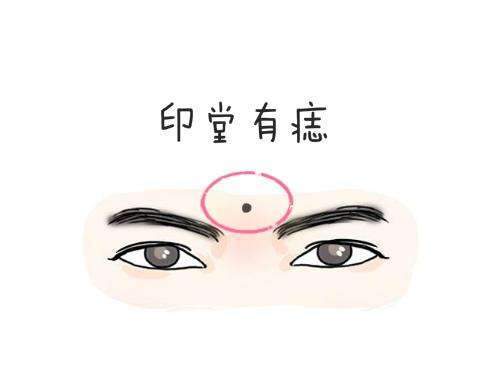 面部痣的位置与命运，看看你有没有富贵痣 