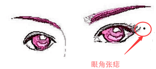 旺财痣, 身上此处长善痣, 发横财, 进偏财, 看你脸上得是不是