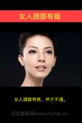 女人颈部有痣