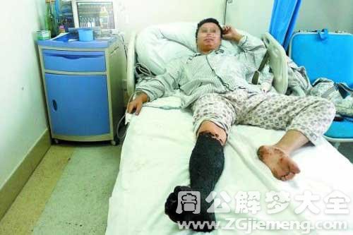 梦见被蛇咬了腿