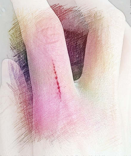  梦见手划破