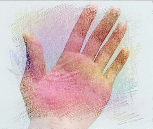 梦见手掌裂开