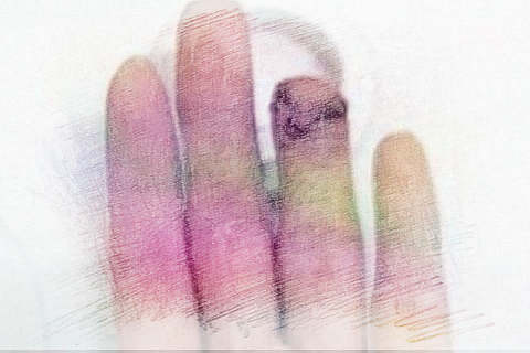 手腐烂了