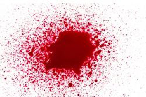 梦见自己拉血 梦见自己拉血