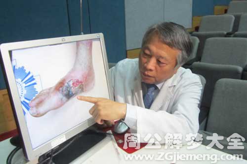 伤口恶化