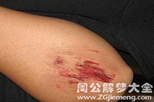 伤口出水 伤口出水