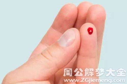 手被玻璃划破 手被玻璃划破