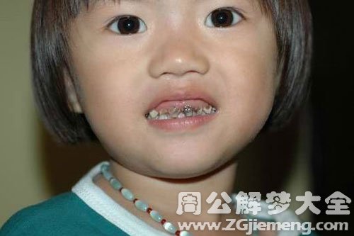 梦见牙变黑掉了 梦见牙变黑掉了