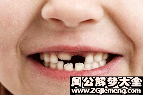 梦见满嘴牙掉了